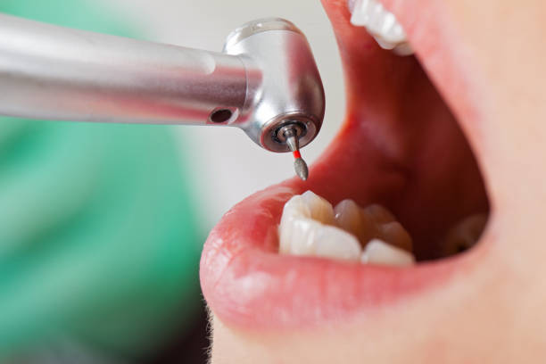 Best Emergency Broken Tooth Repair in Clinton, KY